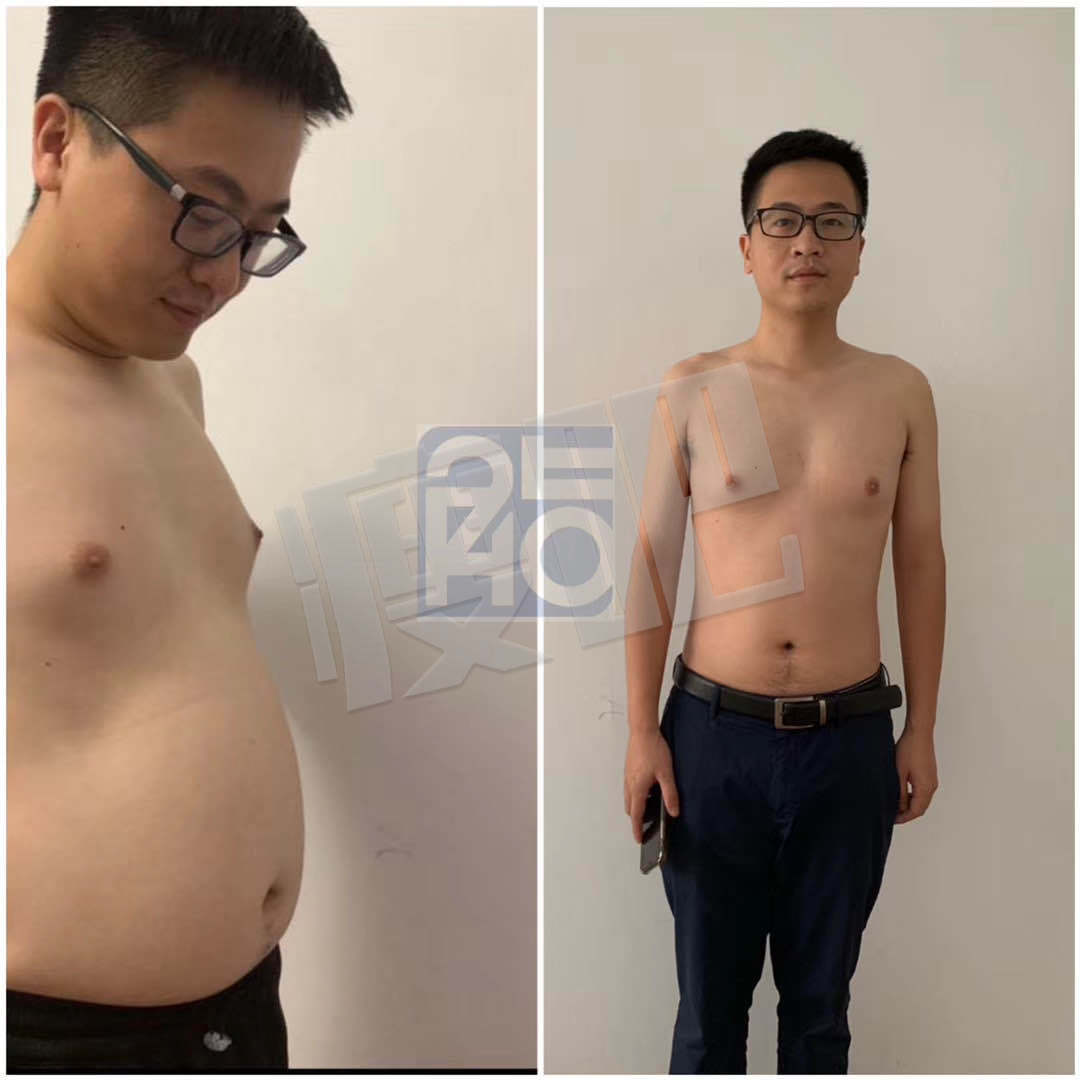 啤酒肚小哥哥减2⃣️0⃣️斤 肚子没有了,人也自信了!