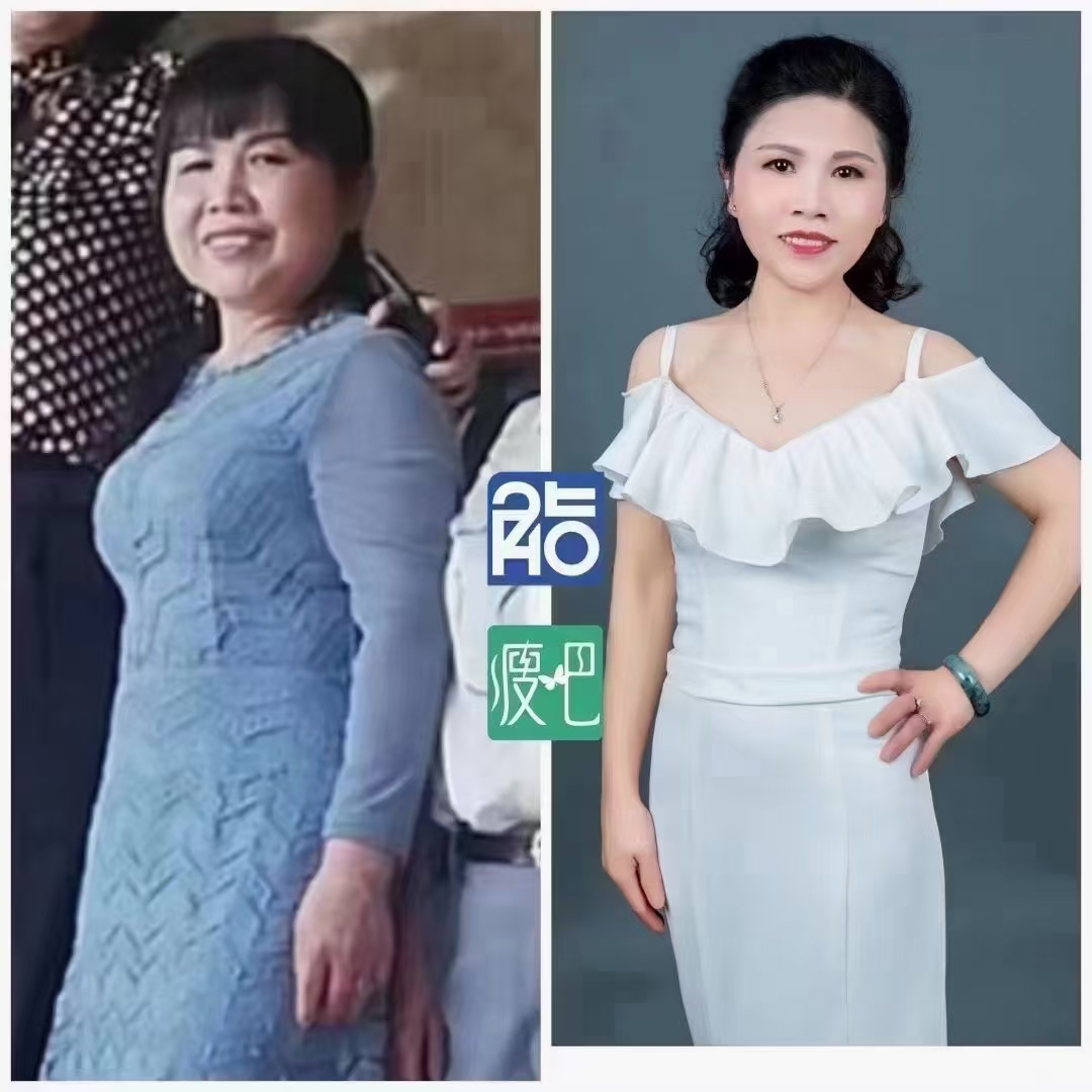 60岁阿姨的蜕变-瘦圈-广州瘦吧网络科技有限公司